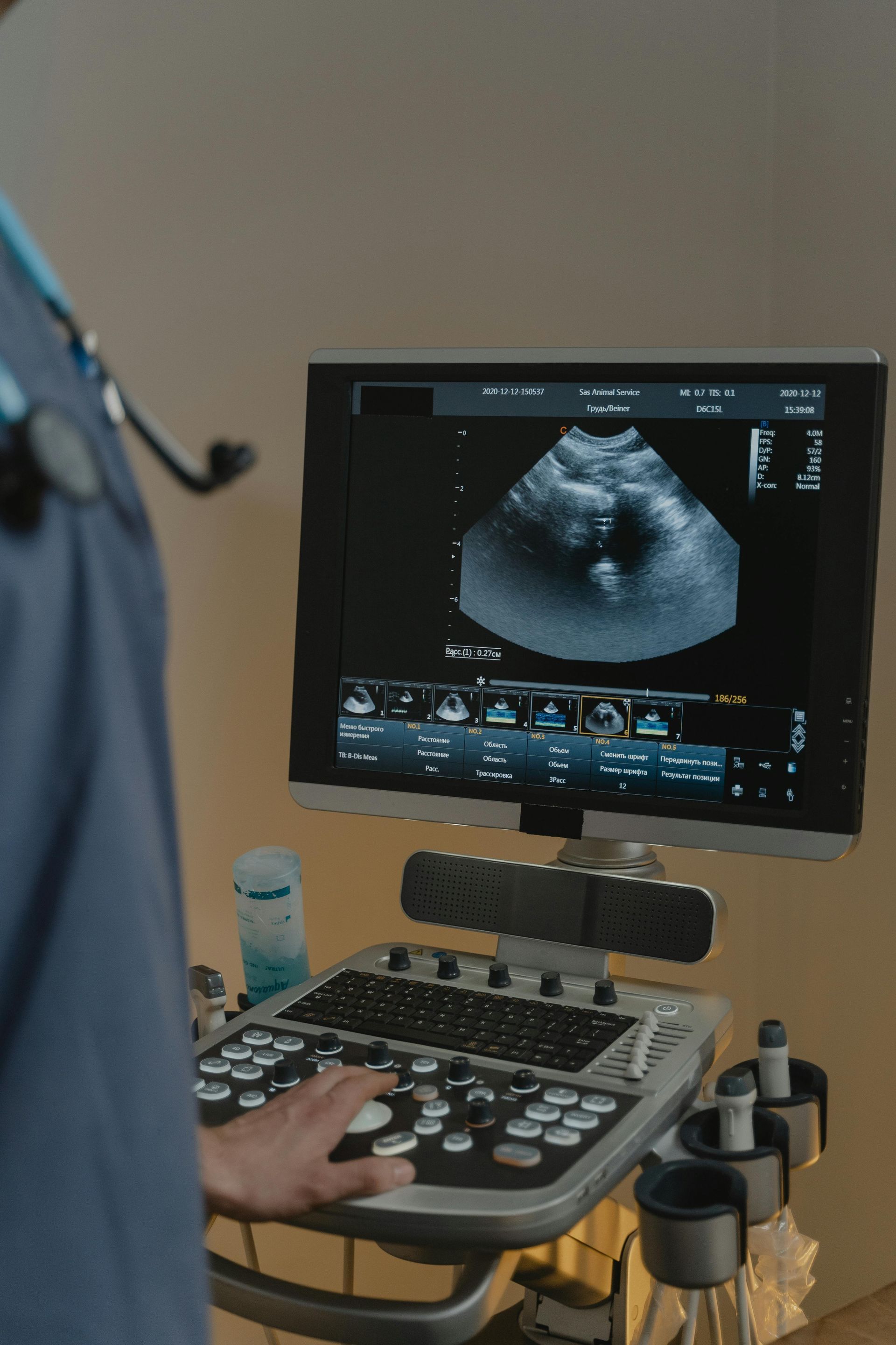 Echographie prostatique
