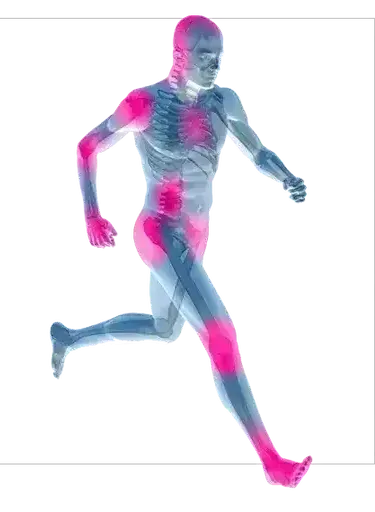 A Skeleton of a Man Running With Pink Spots on His Body — Northern Beaches GP Superclinic in Deeragun, QLD