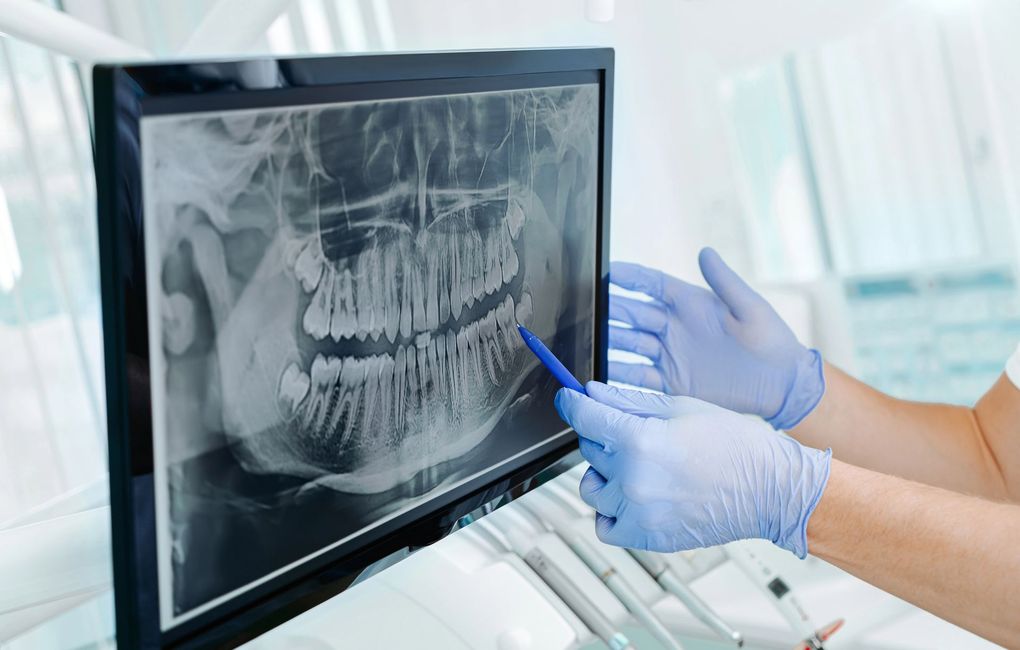 Studio Dentistico Murruni, Giussano, chirurgia orale