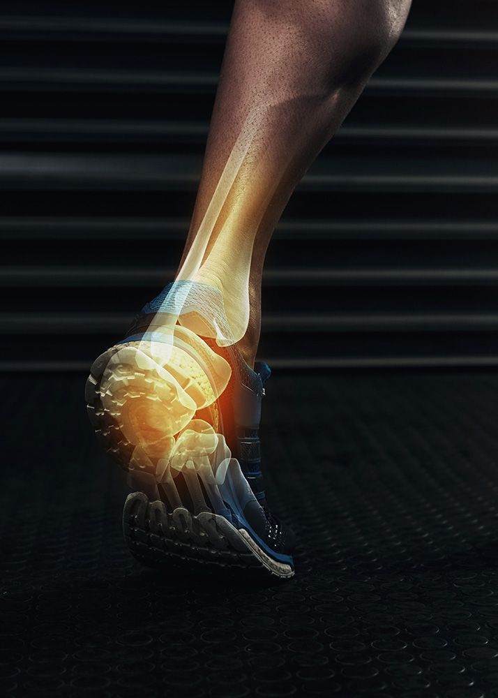 Ankle Arthroscopy