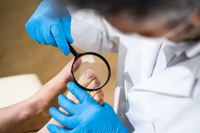 A podiatrist in blue gloves examines a foot with a magnifying glass in an office setting.