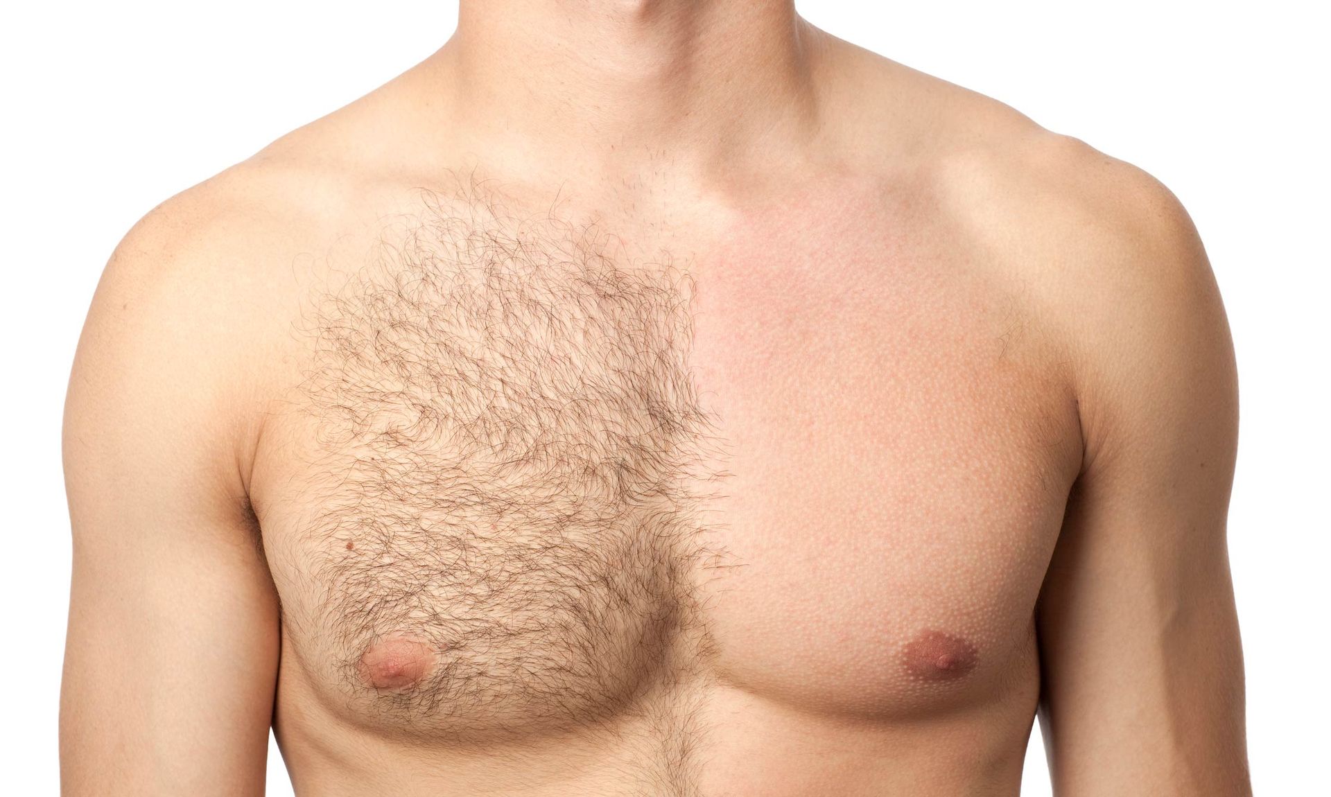 Portrait Of Man Chest In Waxing Treatment — Centerville, OH — Elegant Permanent Cosmetics & Skincare Portrait Of Man Chest In Waxing Treatment — Centerville, OH — Elegant Permanent Cosmetics & Skincare