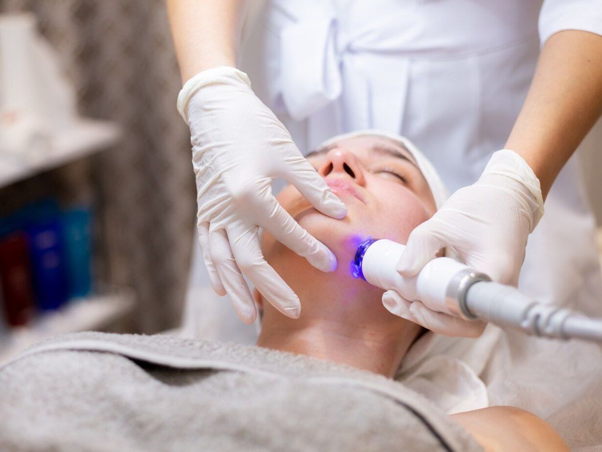 Facial Laster Treatment for Skin Imperfections