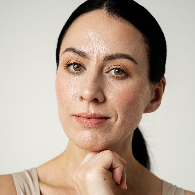 A close up of a woman 's face after fine line, wrinkle treatment