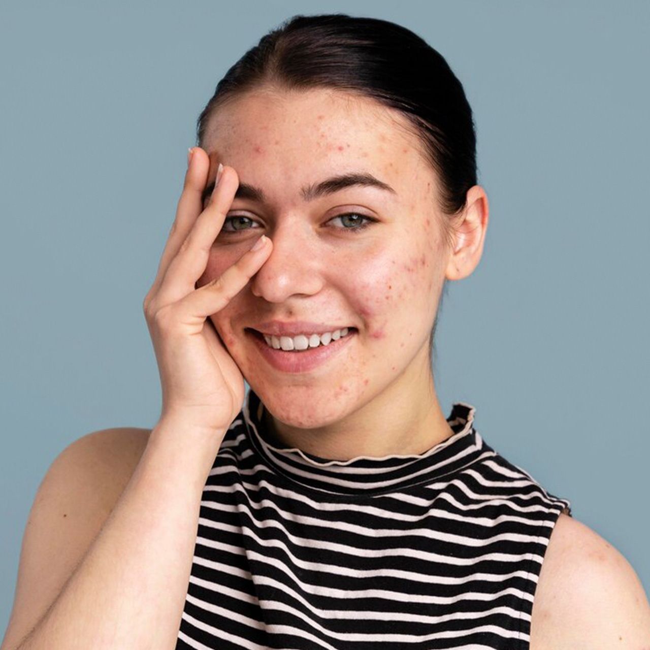 A woman in a striped shirt is smiling and covering her face with her hand.