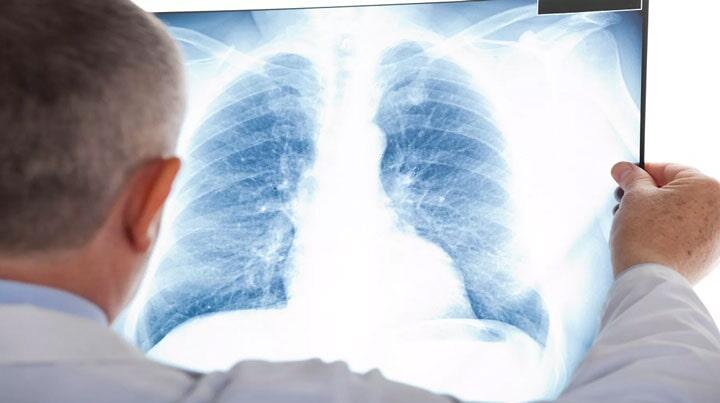 TERAPIA RESPIRATORIA AMCI UNIDAD MÉDICA - Inhaloterapia