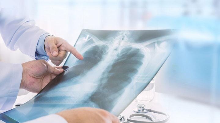 TERAPIA RESPIRATORIA AMCI UNIDAD MÉDICA - Vía Respiratoria