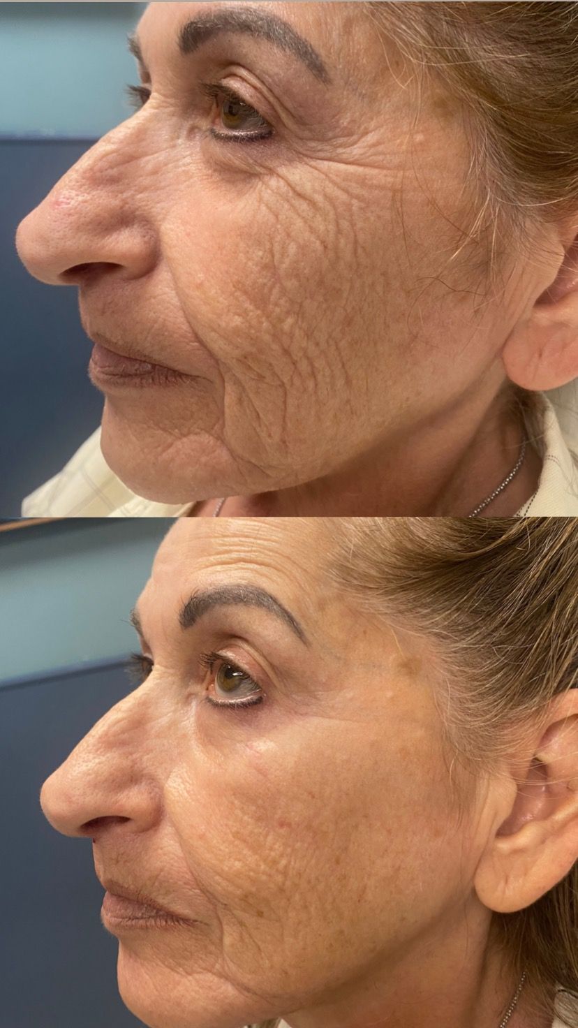 osmetic Dermatology, Skin Checks, Botox, Fillers