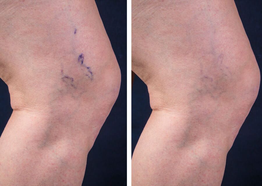 Cosmetic Dermatology, Skin Checks, Botox, Fillers, Sclerotherapy,