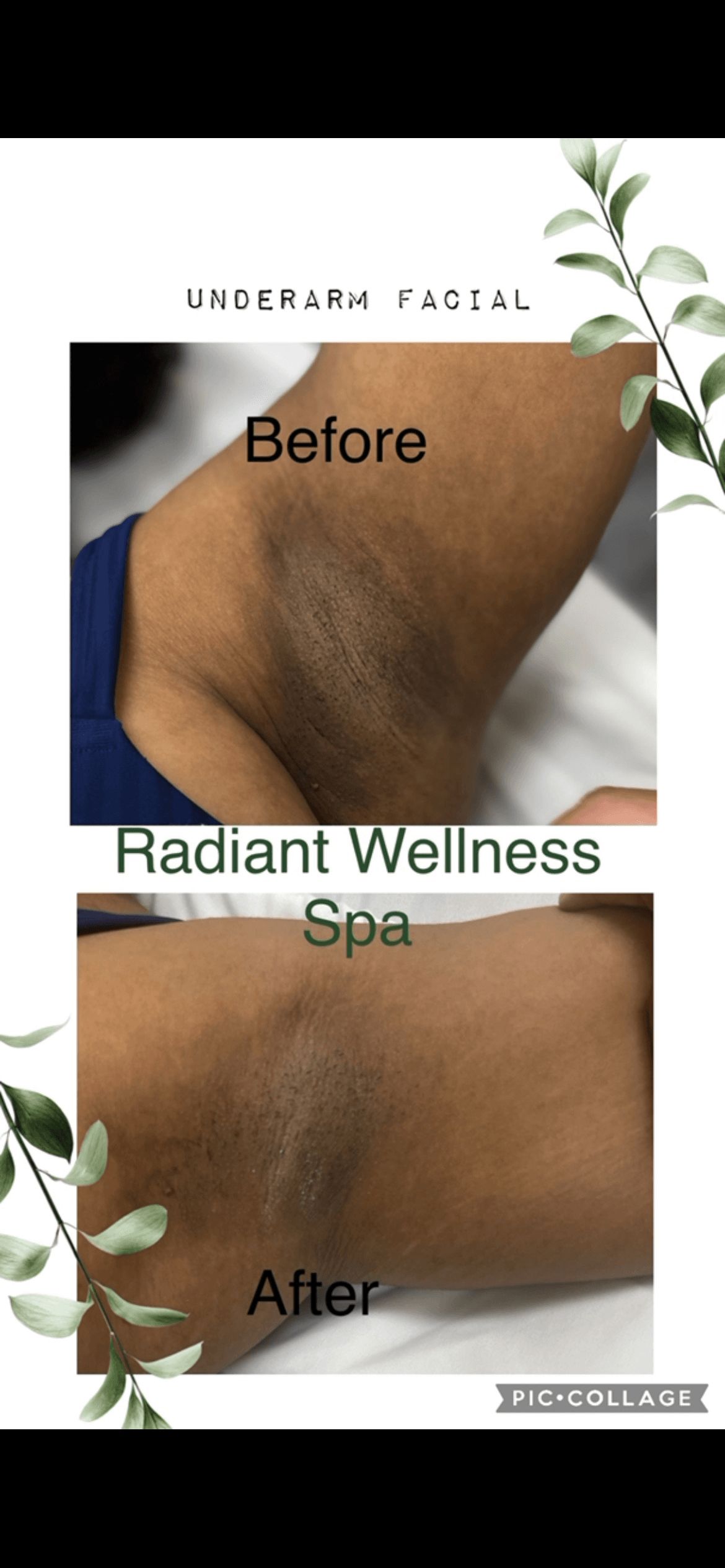 close-up of before and after underarm facial before and after.