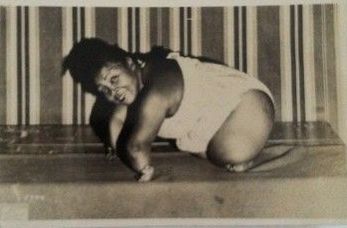 Woman with shortened limbs in a white swimsuit, smiling. Kneeling on a surface, striped background.