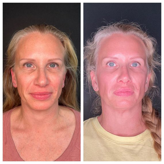 Two side-by-side portrait photos of a person, one normal and one with a bright flash effect.