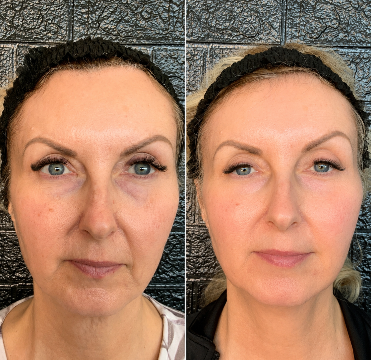 Before-and-after face comparison showing a woman with natural skin and a retouched, smoother version.