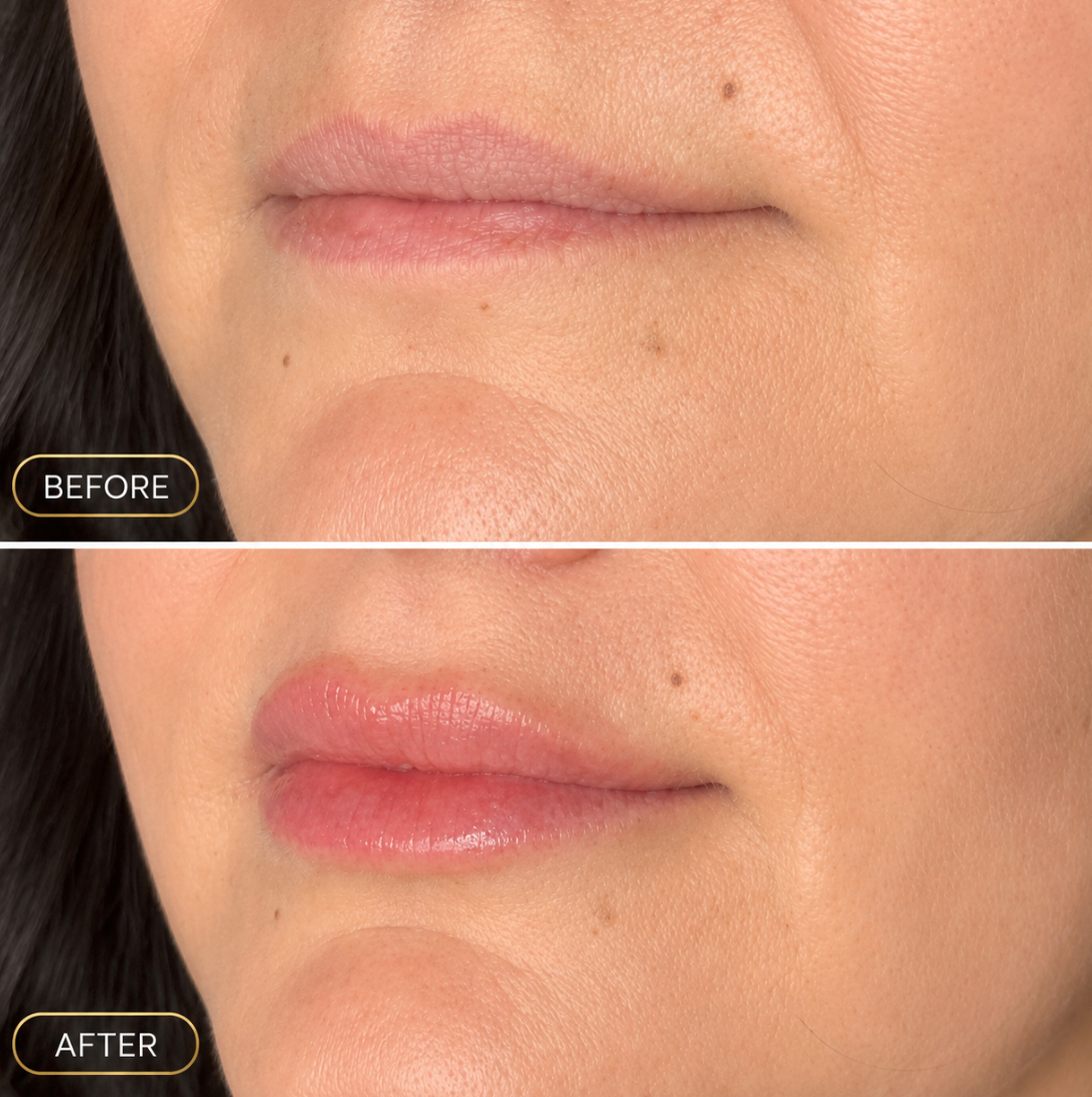 Split before-and-after close-up of lips, showing fuller, glossier lips in the after image.