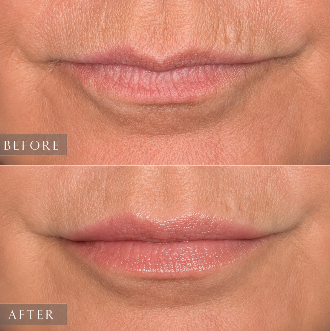 Before-and-after close-up of lips, showing smoother, glossier lips in the after image.
