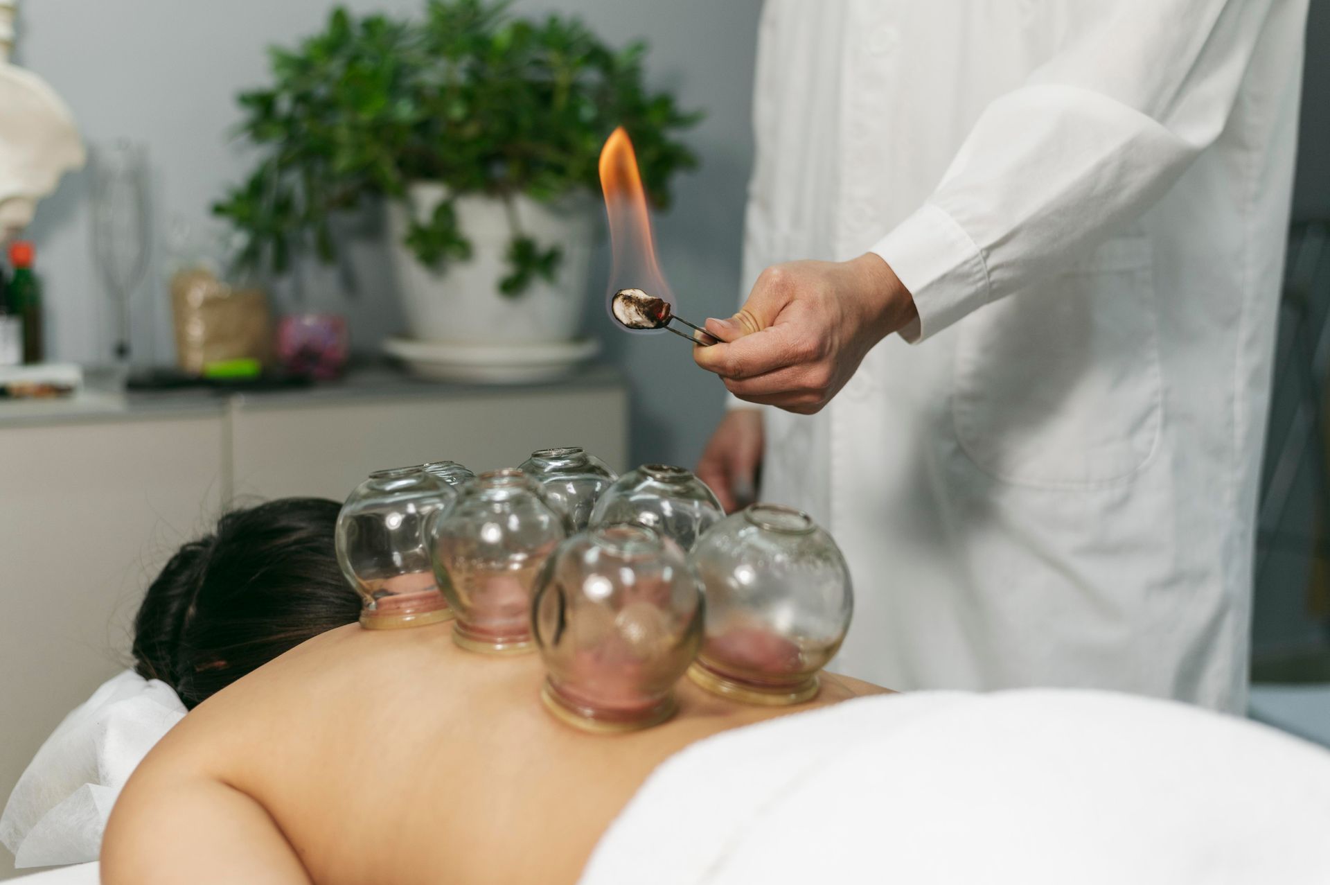 A man is getting a cupping treatment on his back.