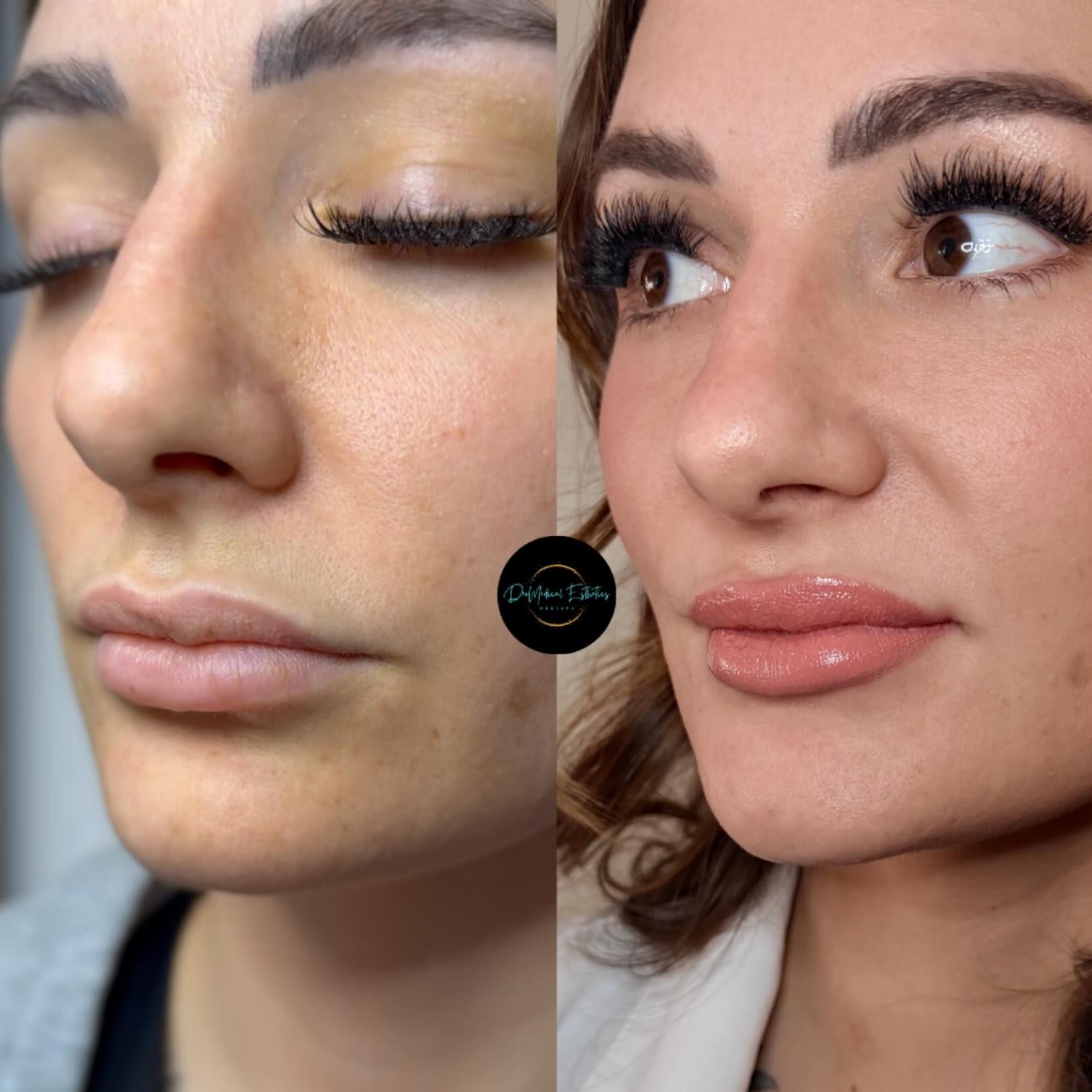 Before and after photos of a person's face. The 