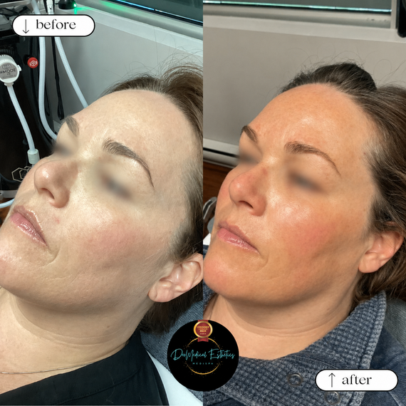 Split-screen before and after of a facial treatment, showing a pale face beside a more radiant, bronzed face.