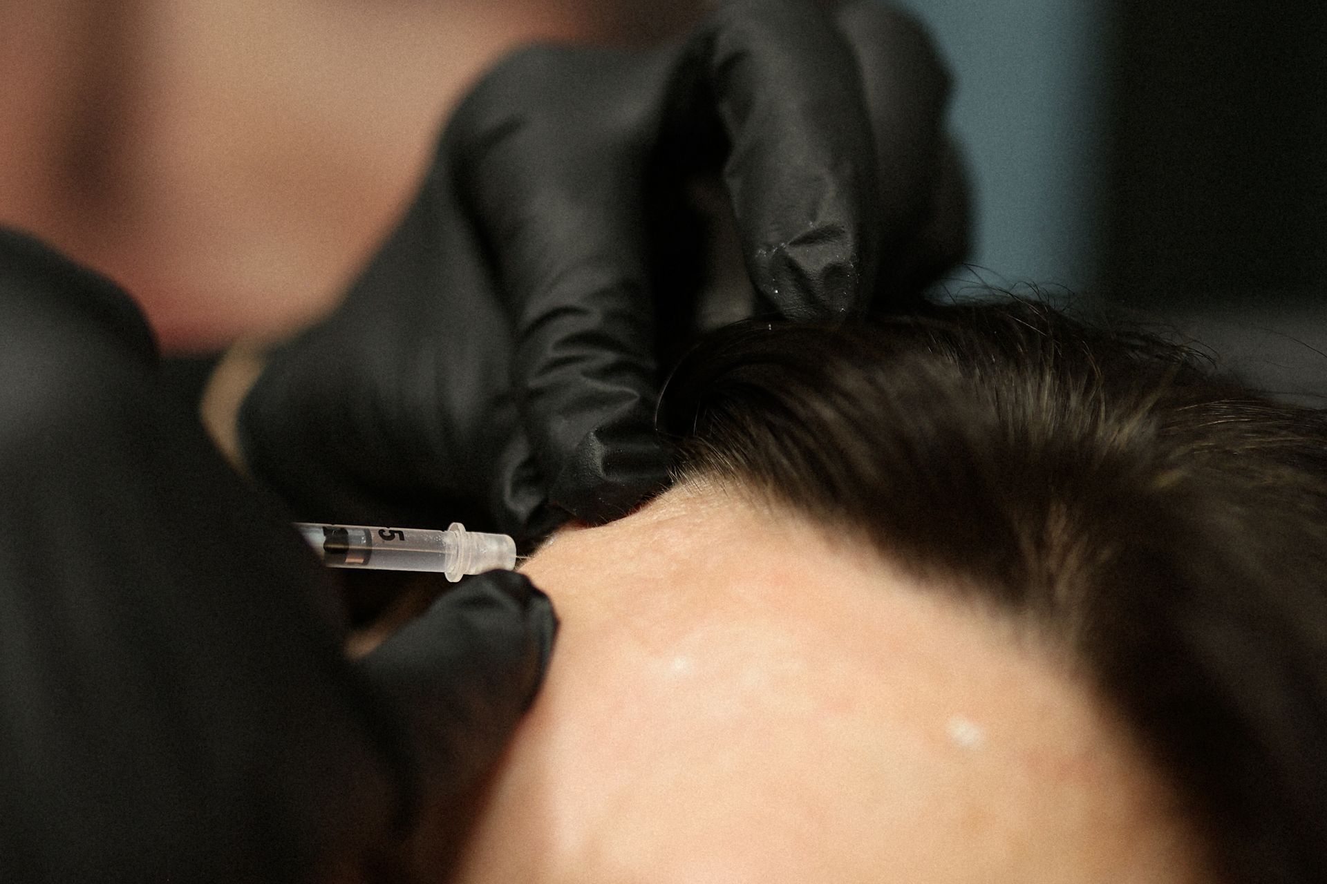 Hands in black gloves injecting a syringe into a person's forehead.