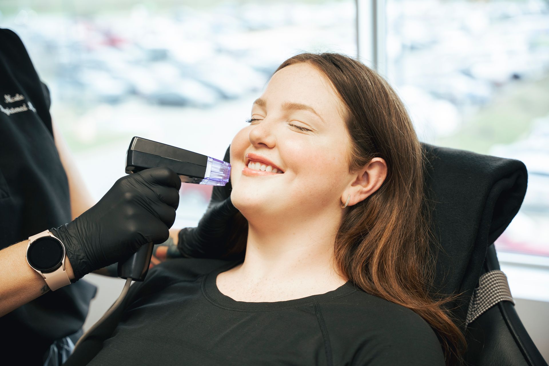 Woman receiving microneedling treatment. Smiling, eyes closed; black-gloved hand holding device to her face.