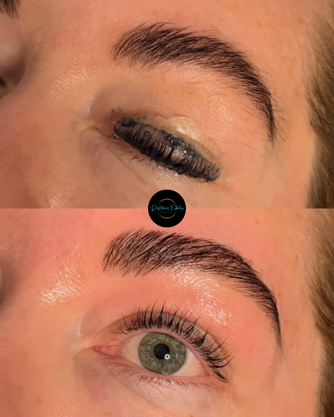 Close-up of an eyebrow and eye before-and-after beauty treatment