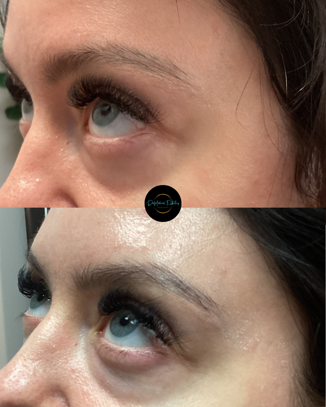 Side-by-side close-up of an eye before and after makeup, showing a brighter, more defined under-eye area