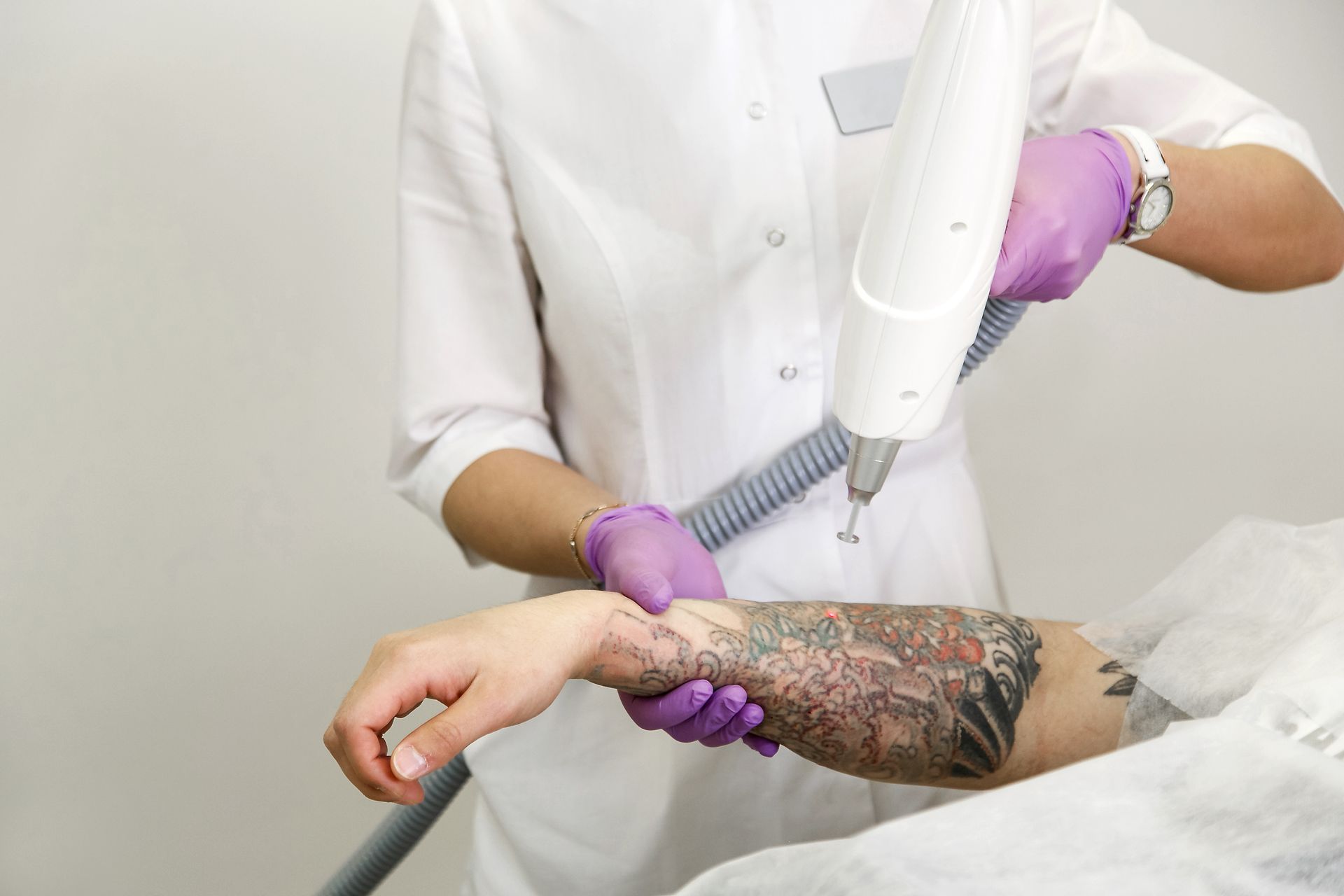 Person in white coat using a laser to remove a tattoo on an arm. Purple gloves, neutral setting.