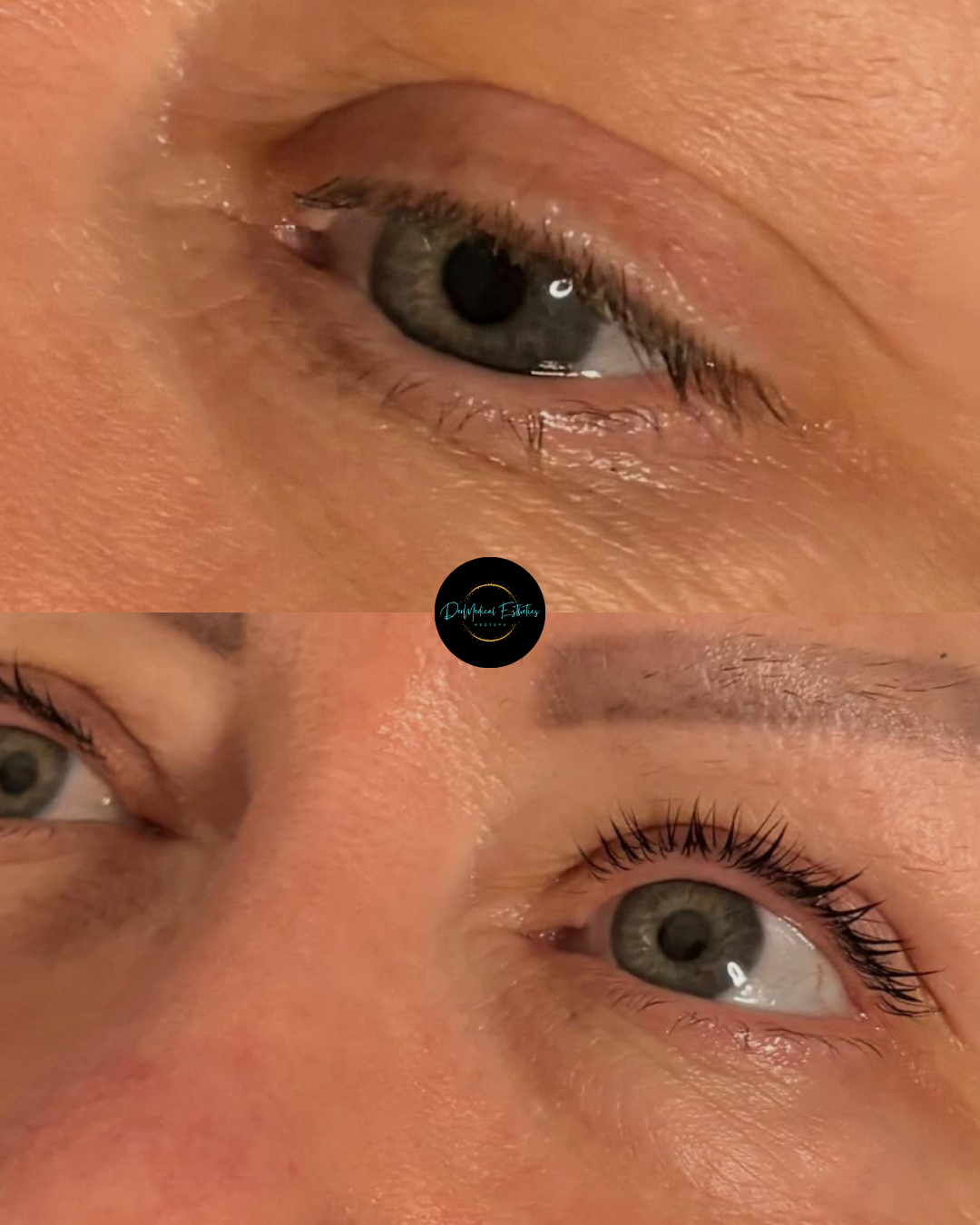 Close-up collage of three eyes with neutral expressions, showing gray-green irises and natural makeup.