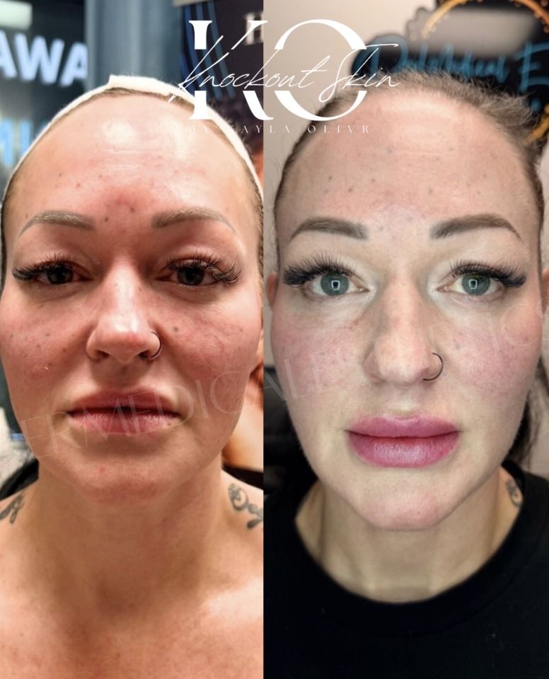 Before-and-after facial photos showing skin redness and makeup differences.