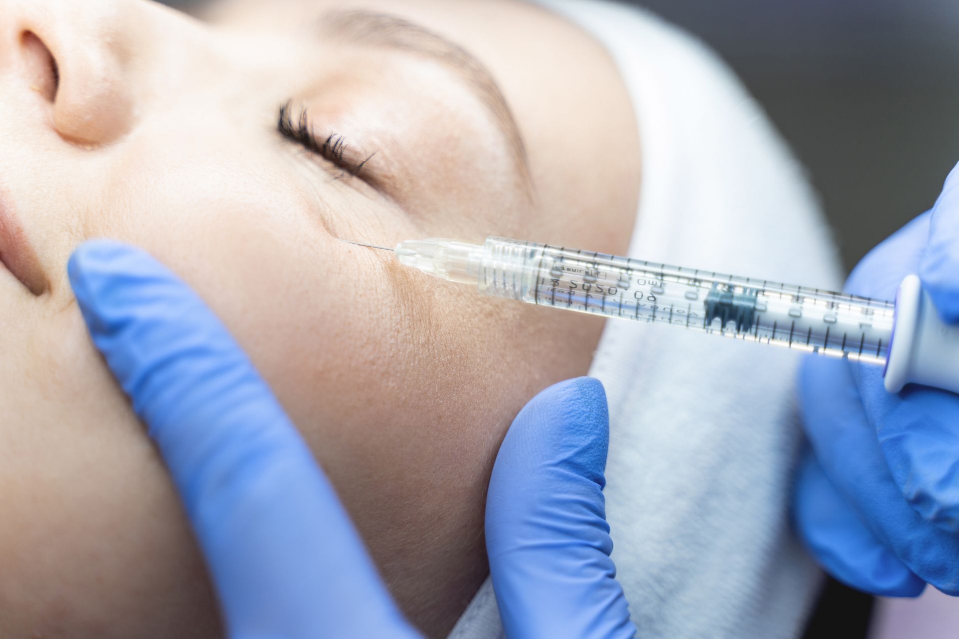 Cosmetic injection being administered to a woman’s cheek with a syringe and gloved hands