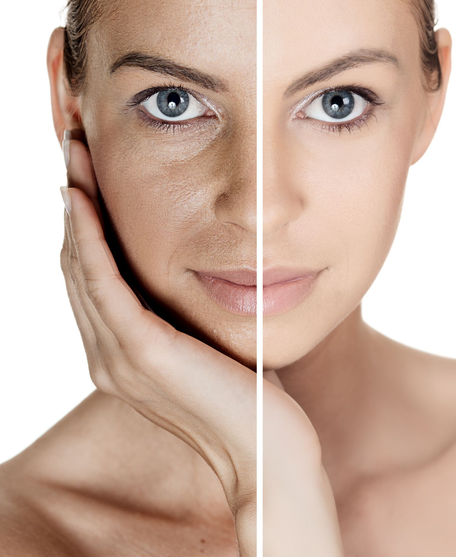 Split-face portrait showing one half wrinkled and sun-damaged, the other half smooth and clear, hand on chin