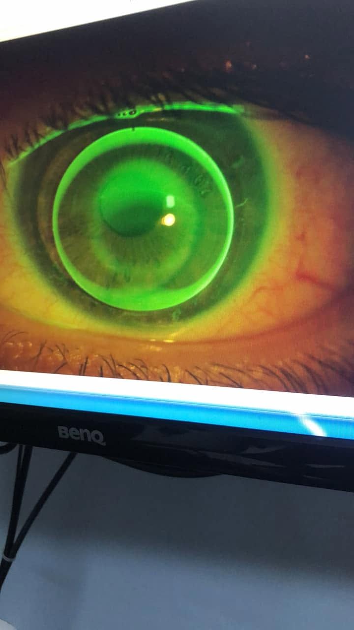 Primo piano di un occhio verde con un riflesso circolare luminoso sullo schermo di un computer.