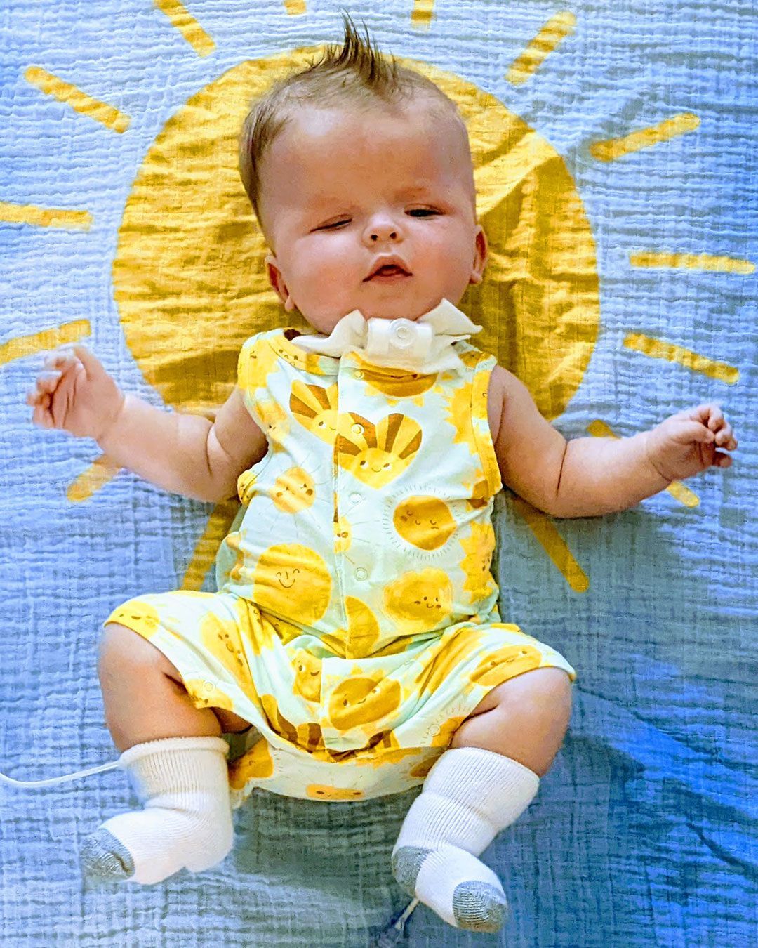 onny is wearing a onesie with smiling suns while lying on a blanket with a giant sun and blue sky background.
