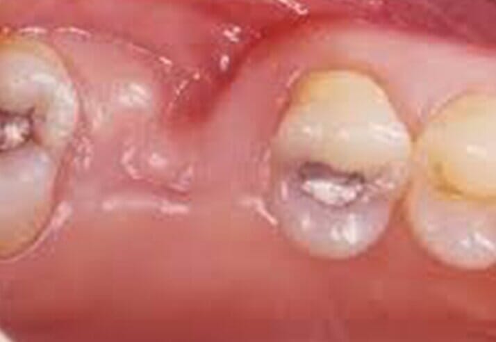 Teeth — Riviera Beach, FL — Singer Island Dentistry