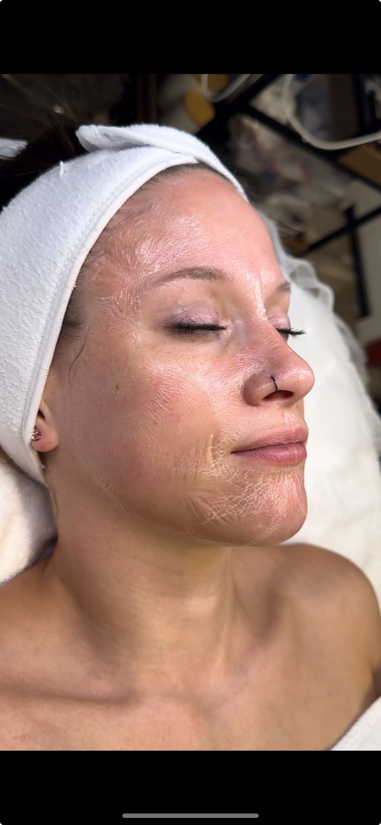 Peptide Tightening and Brightening Rejuvenation Mask