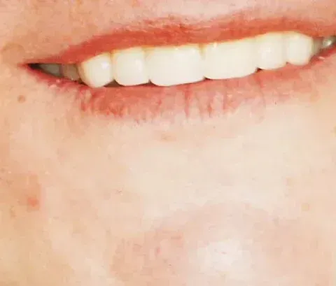 Close-up of a smiling mouth with slightly parted lips and white teeth
