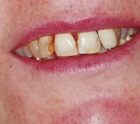 Close-up of lips and teeth with a noticeable gap and slight discoloration
