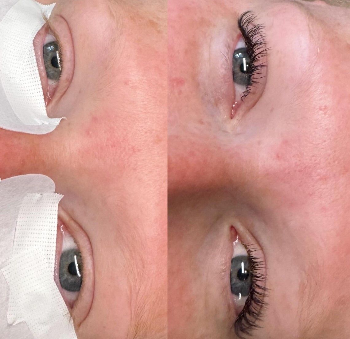 A close up of a person 's face with a bandage on it