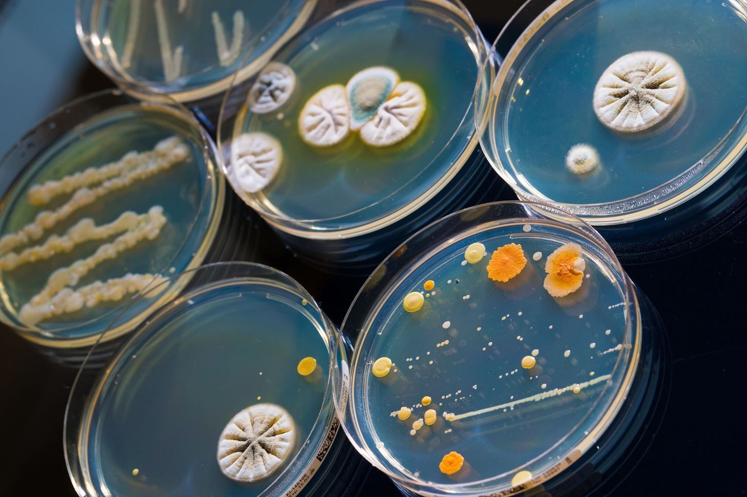 Petri dishes with various bacterial and fungal colonies in a lab setting.