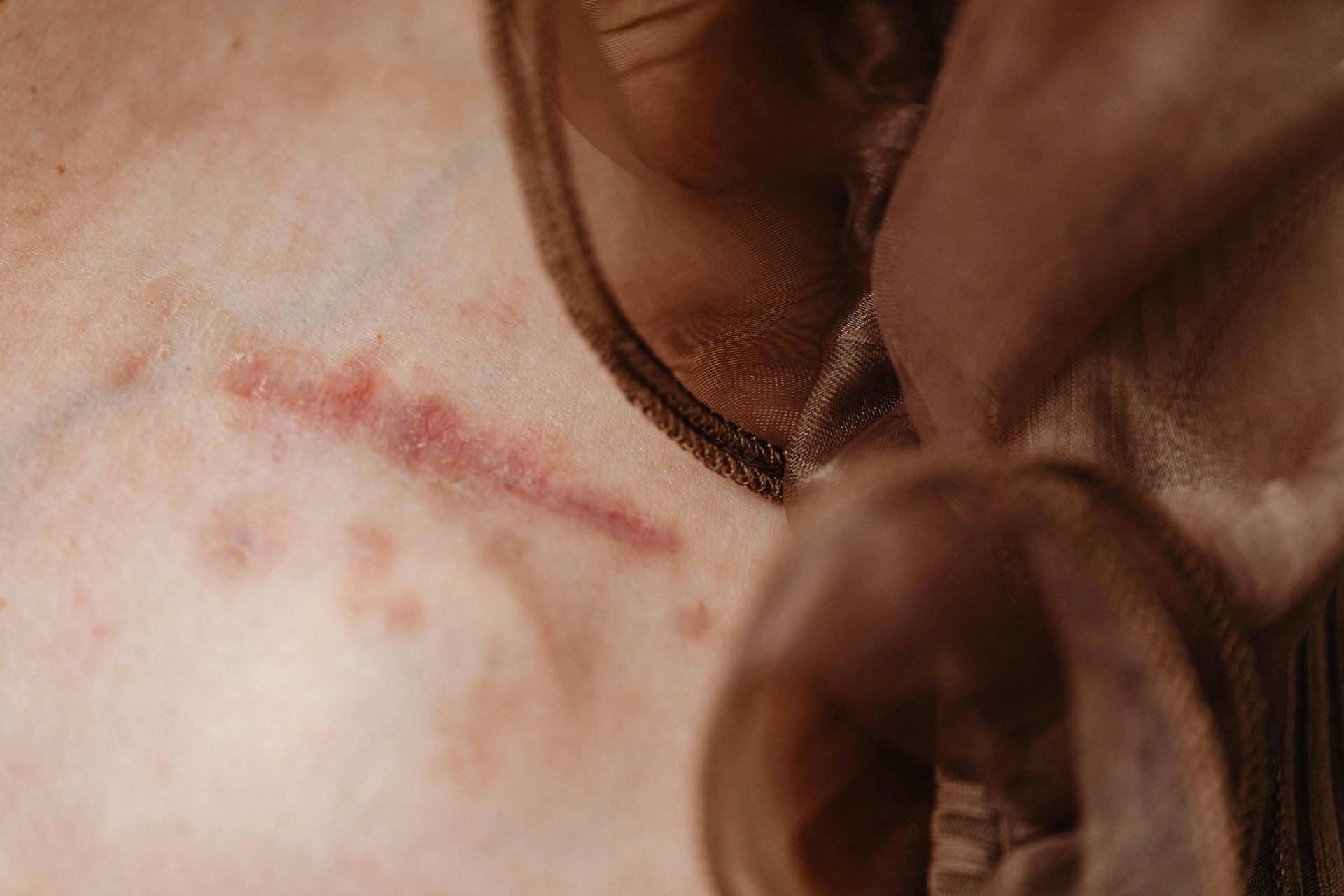 Personal Injury Lawyer
