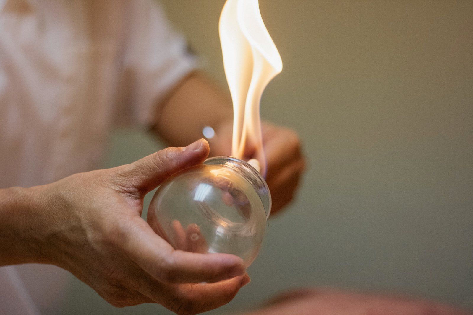 Fire Cupping Whitby