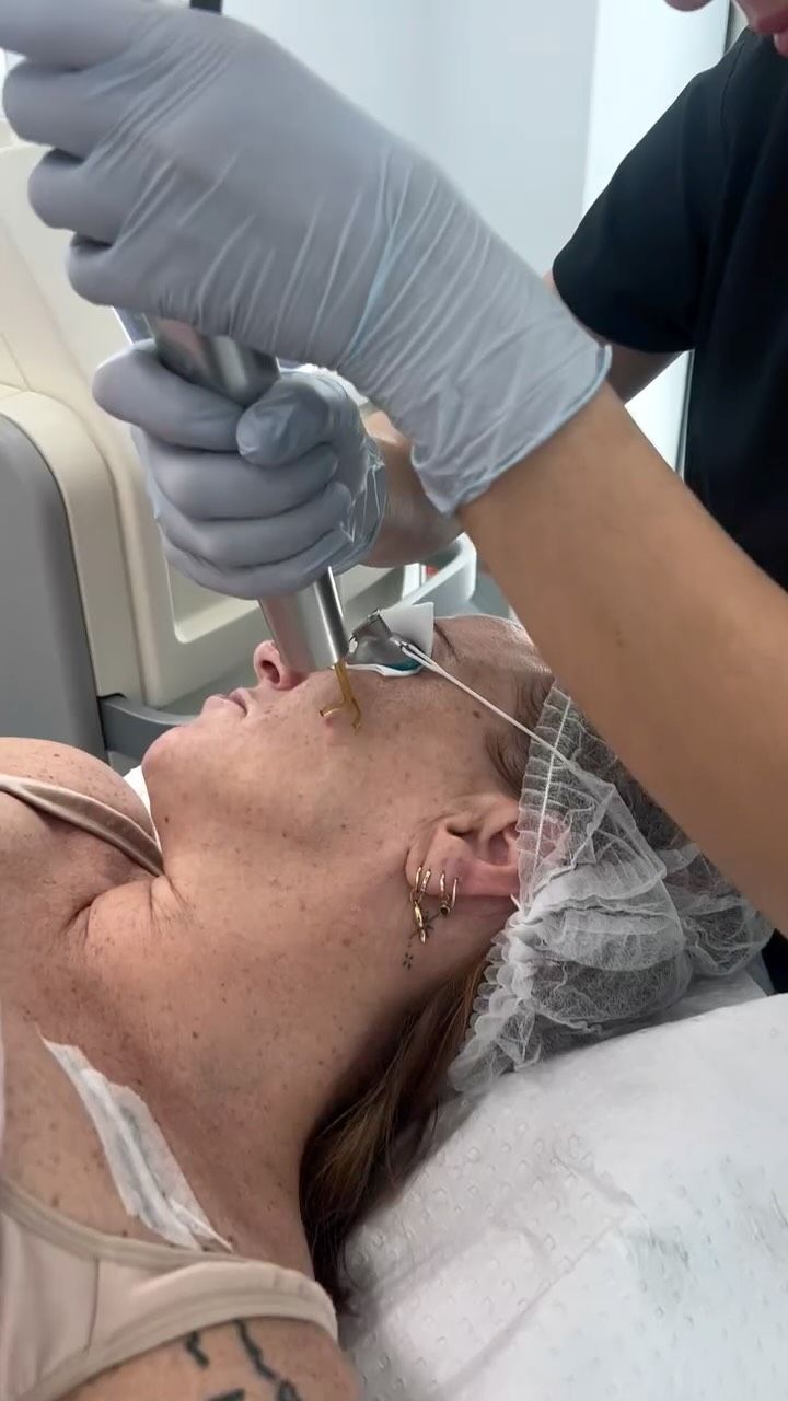 A clinician injects treatment into a patient's cheek during a cosmetic procedure.