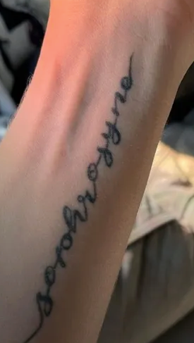 A Tattoo That Will Be Removed — That Skin Clinic in Mooloolaba, QLD