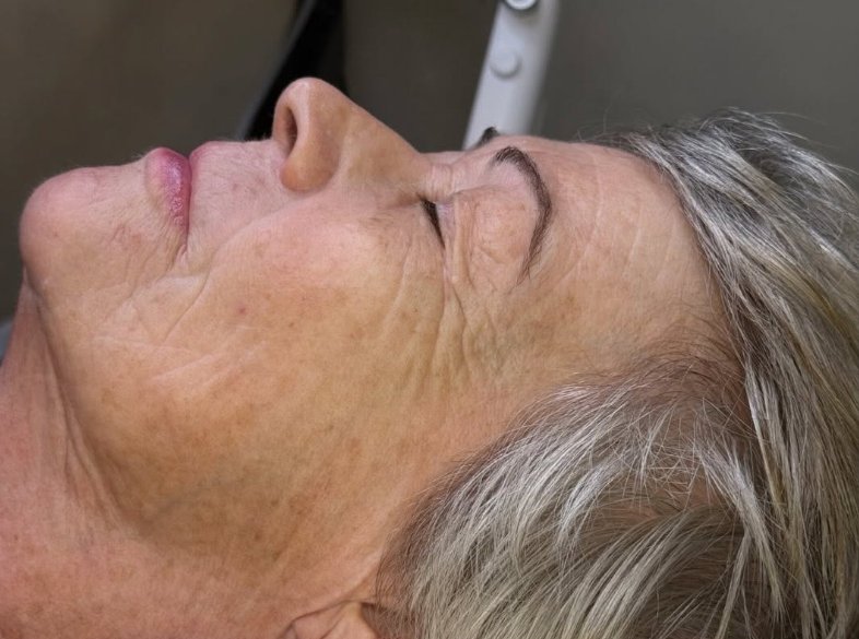 Side profile of a woman lying back, showing skin texture and fine lines around her jawline and neck.