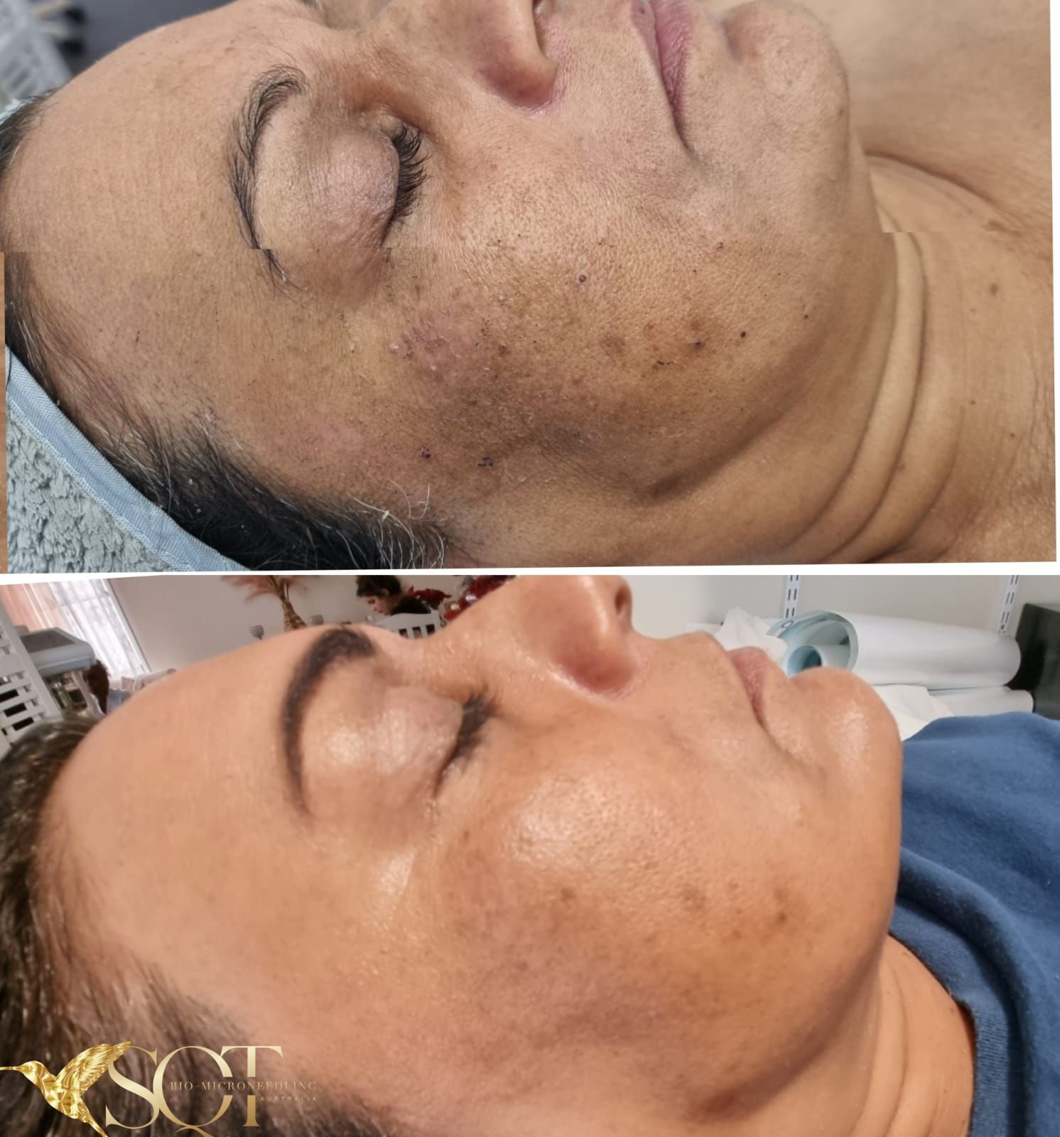 Close-up of a Woman Lying on Her Side With Eyes Closed — That Skin Clinic in Mooloolaba, QLD