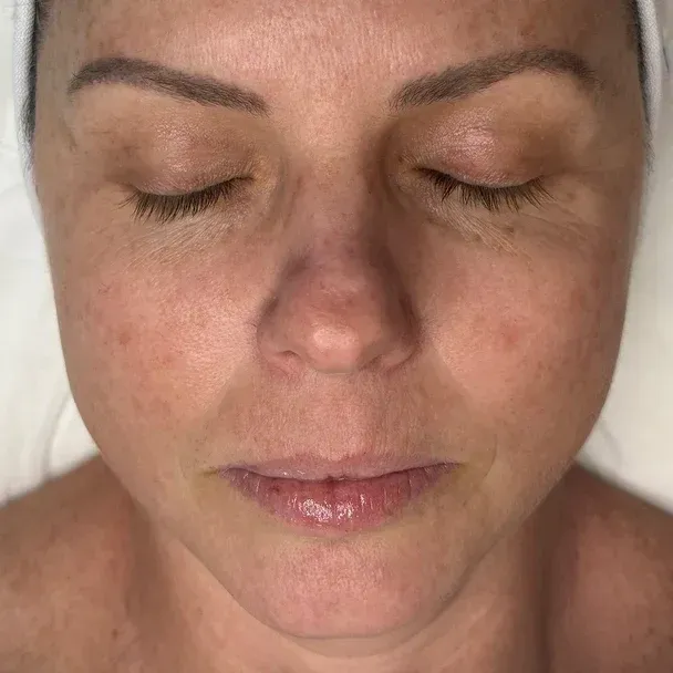 A person with closed eyes, fair skin, and freckles. Light tan skin with light lip color.