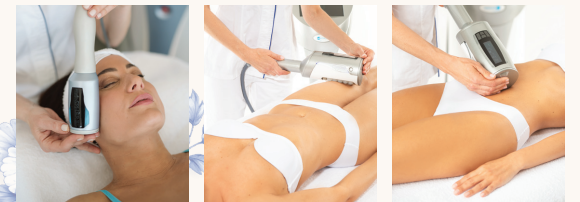 Laser hair removal on a person’s body in a spa treatment setting, shown in three close-up views