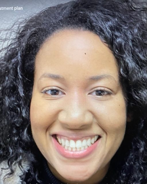 Invisalign Treatment in Plymouth, MA