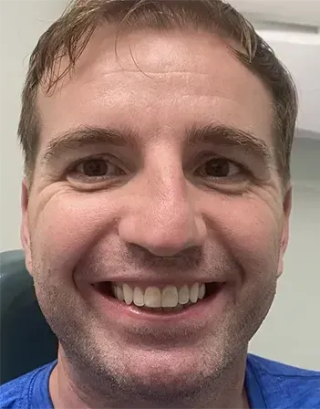 Invisalign Treatment in Plymouth, MA