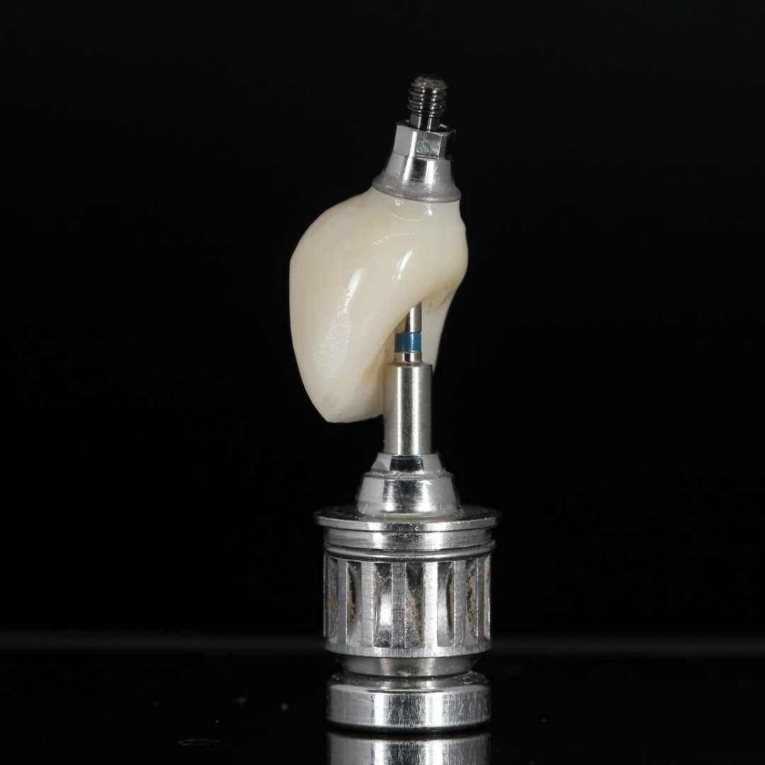 dental implant crown best near me